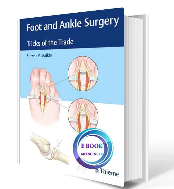 دانلود کتاب Foot and Ankle Surgery: Tricks of the Trade 2018(ORIGINAL PDF)